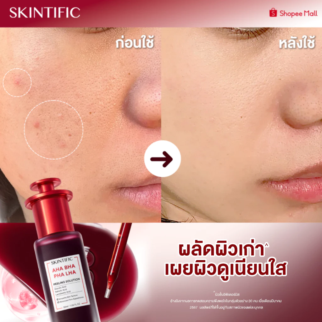 SKINTIFIC AHA BHA PHA LHA Peeling Solution serum essence เซรั่มเพื่อการ โทนอัพ ที่มีส่วนผสมของ AHA BHA น้ําตบ โทนเนอร์