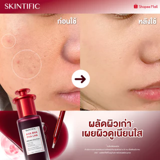 SKINTIFIC AHA BHA PHA LHA Peeling Solution serum essence เซรั่มเพื่อการ โทนอัพ ที่มีส่วนผสมของ AHA BHA น้ําตบ โทนเนอร์