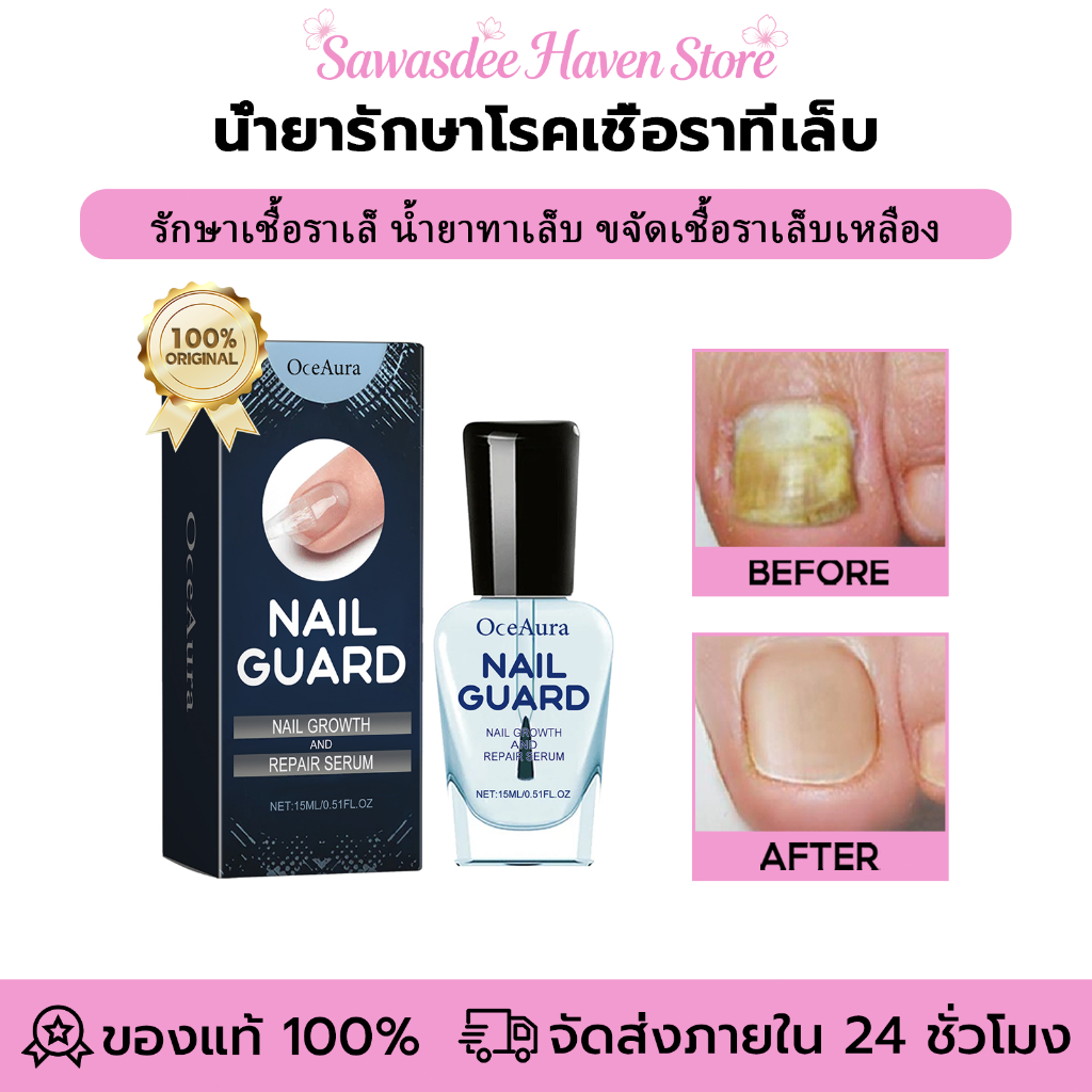 OceAura น้ำยาเลี้ยงเล็บ เซรั่มบำรุงเล็บ บำรุงเล็บ ต่อต้านการติดเชื้อรา ฟื้นฟูเล็บเสีย เล็บบาง เล็บฉีกขาด จากการทาสีเจล