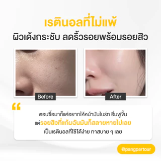 เรตินอล ที่ไม่แพ้ อ่อนโยน สูตร ผิวกระจก 4in1 Natural Retinol Moisturizer สูตร Skin Brightening 45 ml.