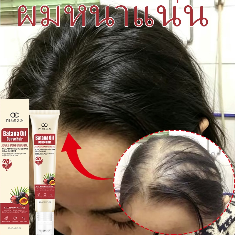 เซรั่มปลูกผม เอสเซ้นผมร่วง 20ml ป้องกันผมร่วง บำรุงรากผม เร่งการเจริญเติบโตของเส้นผม ส่งเสริมการเจริญเติบโตของเส้นผม