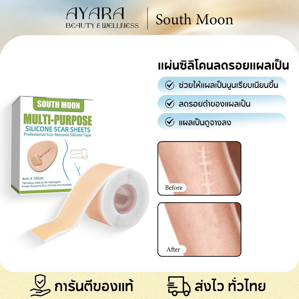 South Moon รักษารอยแผลเป็น แผ่นแปะแผลเป็น ซิลิโคนเกรดทางการแพทย์ กําจัดรอยแผลเป็นจากแผลเป็น กันน้ำ