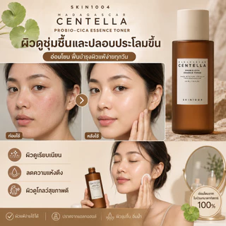 SKIN1004 โทนเนอร์ 210ml. มีหลายสูตรให้เลือก เนื้อบางเบาซึมไว สูตรอ่อนโยน ลดแดง ปลอบประโลมผิวแพ้ง่าย เหมาะกับทุกสภาพผิว