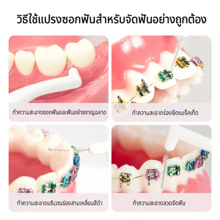 แปรงซอกฟันรูปตัว L ขนแปรงนุ่ม ทำจากสแตนเลส ใช้สำหรับทำความสะอาดอุปกรณ์จัดฟัน มีจำหน่ายในแพ็ค 10 ชิ้น และ 20 ชิ้น