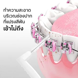 แปรงซอกฟันรูปตัว L ขนแปรงนุ่ม ทำจากสแตนเลส ใช้สำหรับทำความสะอาดอุปกรณ์จัดฟัน มีจำหน่ายในแพ็ค 10 ชิ้น และ 20 ชิ้น