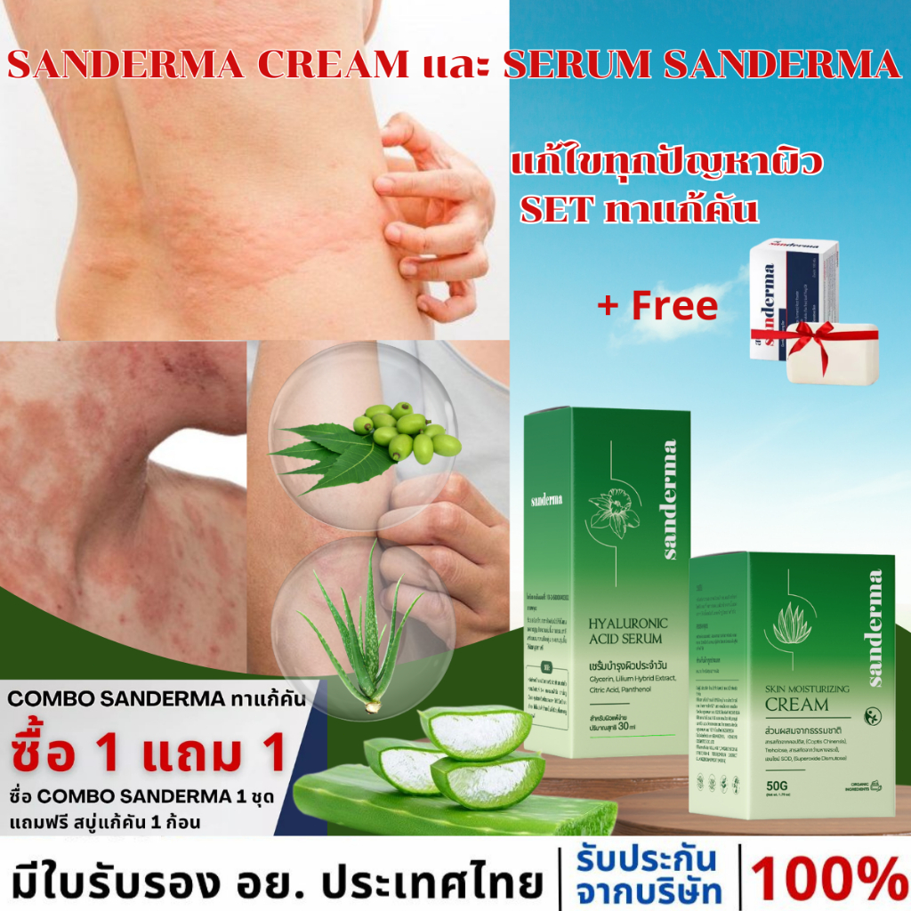 COMBO ทาแก้คัน SANDERMA CREAM และ SERUM SANDERMA เชี่ยวชาญเฉพาะด้าน โรคผิวหนังทุกชนิด โรคสะเก็ดเงิน คัน แพ้เหงื่อ กลากเก