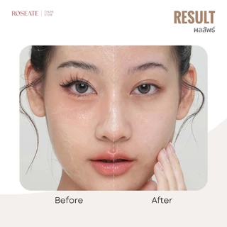 Roseate Centella Soothing Cleansing Milk คลีนซิ่งนม ล้างเมคอัพกันน้ำ ผิวแพ้ง่ายใช้ได้