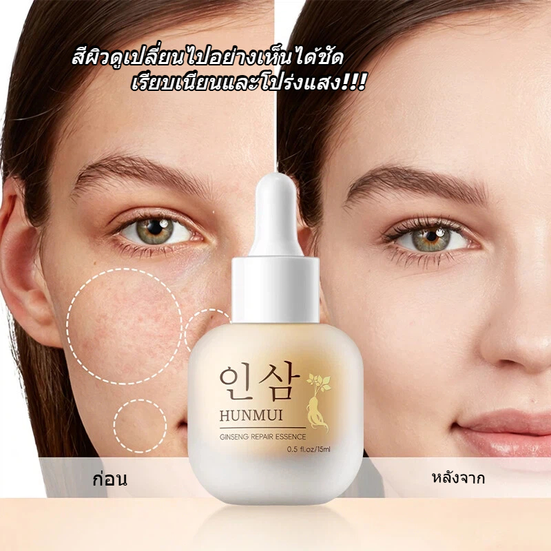 HUNMUI 문아 เซรั่มรากโสม มุนอา เซรั่ม รอยสิว ฝ้า กระ หมองคล้ำ เซรั่มมุนอา ผิวติดสาร สิวอุดตัน รูขุมขนเบียด เซรั่มโสม