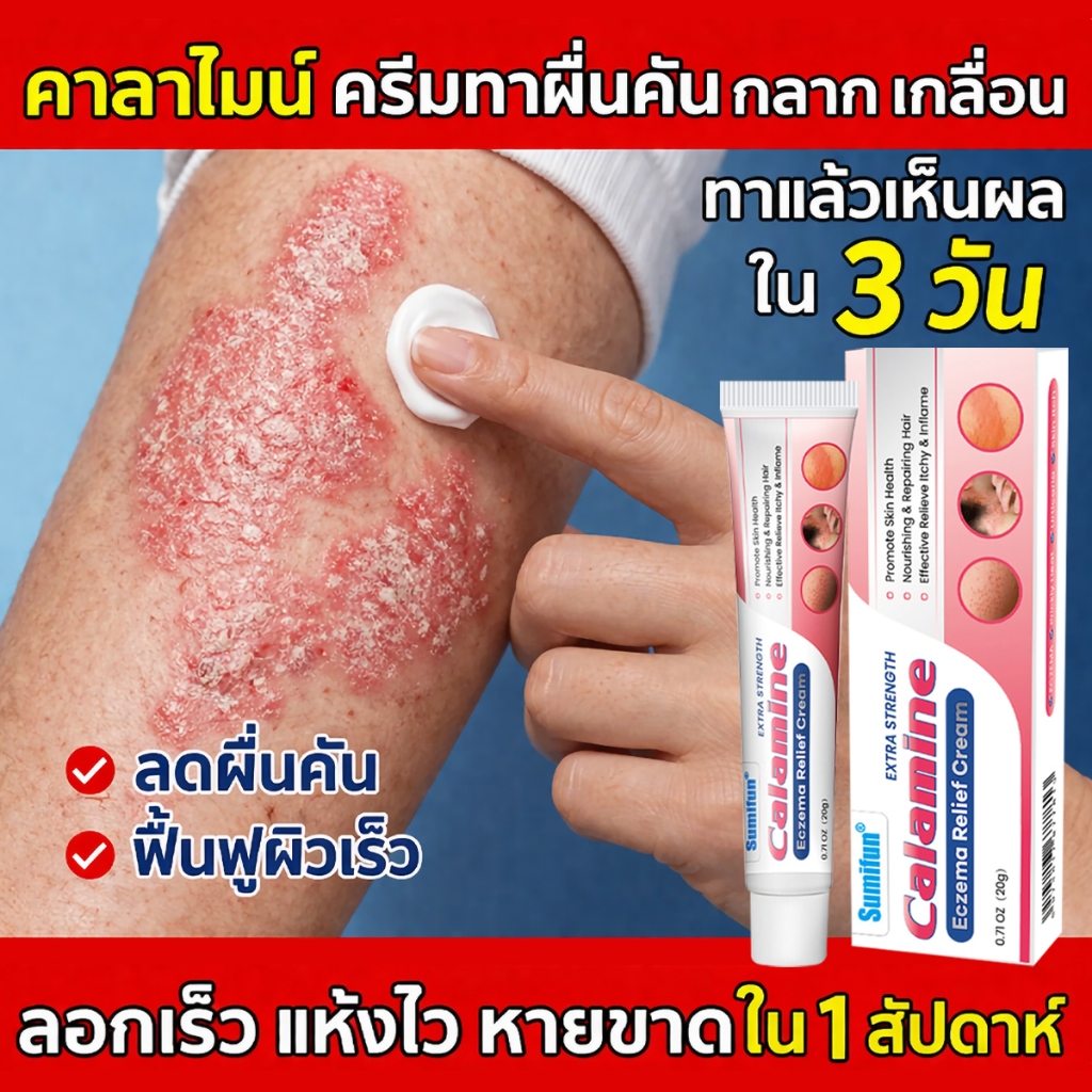 1 ครั้งเห็นผล🔥 ครีมแก้คัน ครีมลดอาการคัน สะเก็ดเงินครีม โรคผิวหนัง เกลื้อน กลาก คัน สมุนไพร แก้คันเรื้อรัง คันในร่มผ้า