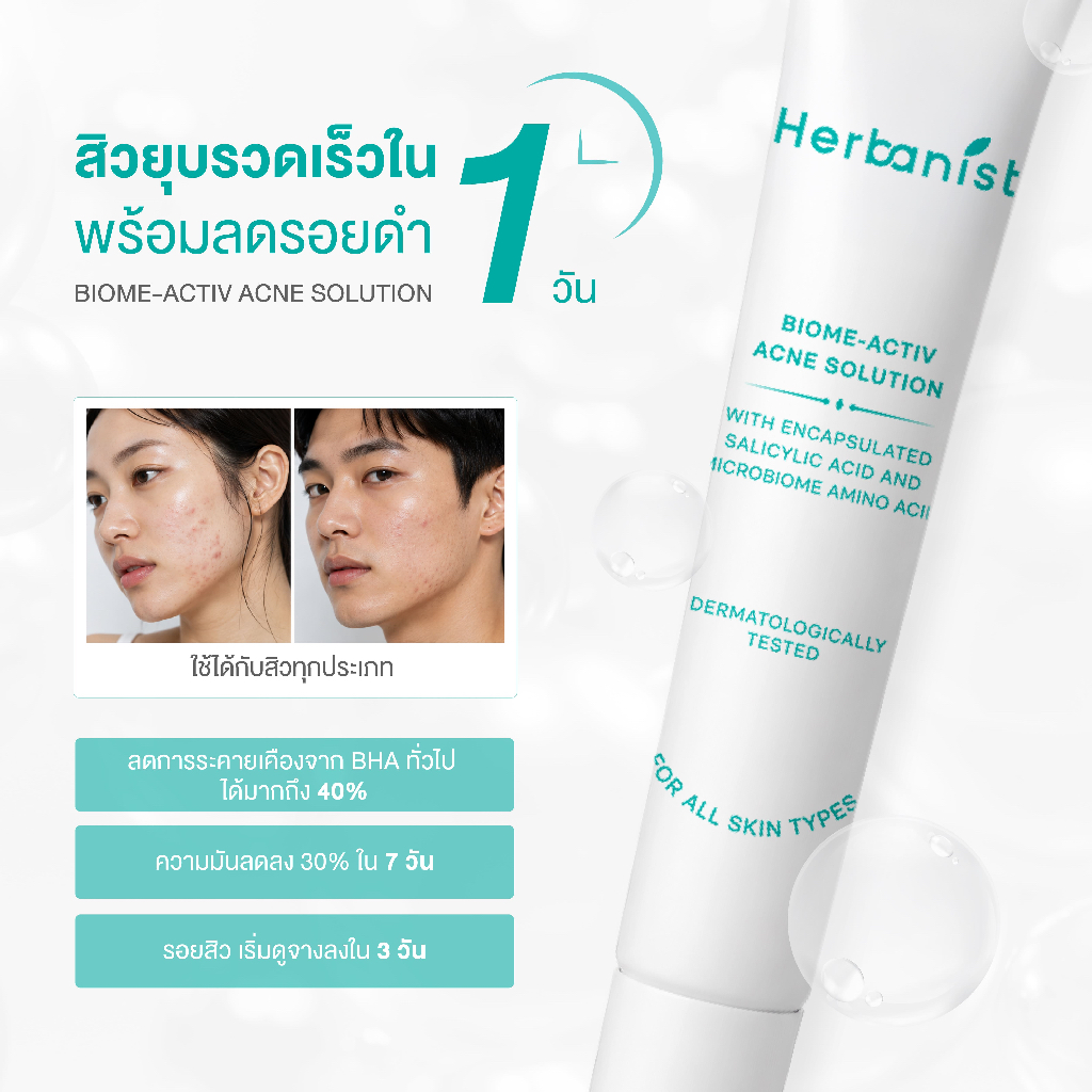 Herbanist جل حب الشباب Biome-Activ ‏Acne Solution — صورة 4