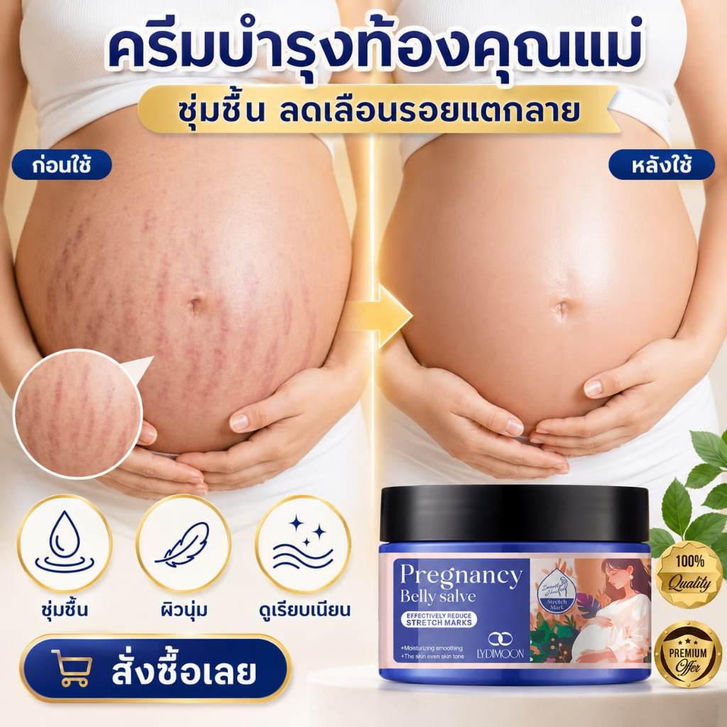 ครีมลดรอยแตกลาย ครีมนวดหน้าท้อง ครีมรักษารอยแตกลาย ลด-ป้องกันแตกลาย ชุ่มชื้น ซึมไว บรรเทาอาการคัน คุณแม่ตั้งครรภ์ใช้ได้