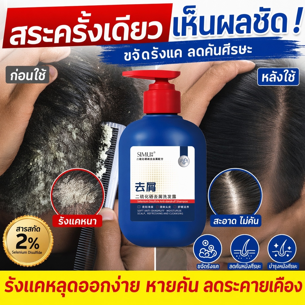 ซีลีเนียมไดซัลไฟด์แชมพู 300มิล กำจัดเชื้อรารังแคไรฝุ่น ควบคุมความมัน ผิวหนังศีรษะสะอาดผมนุ่ม