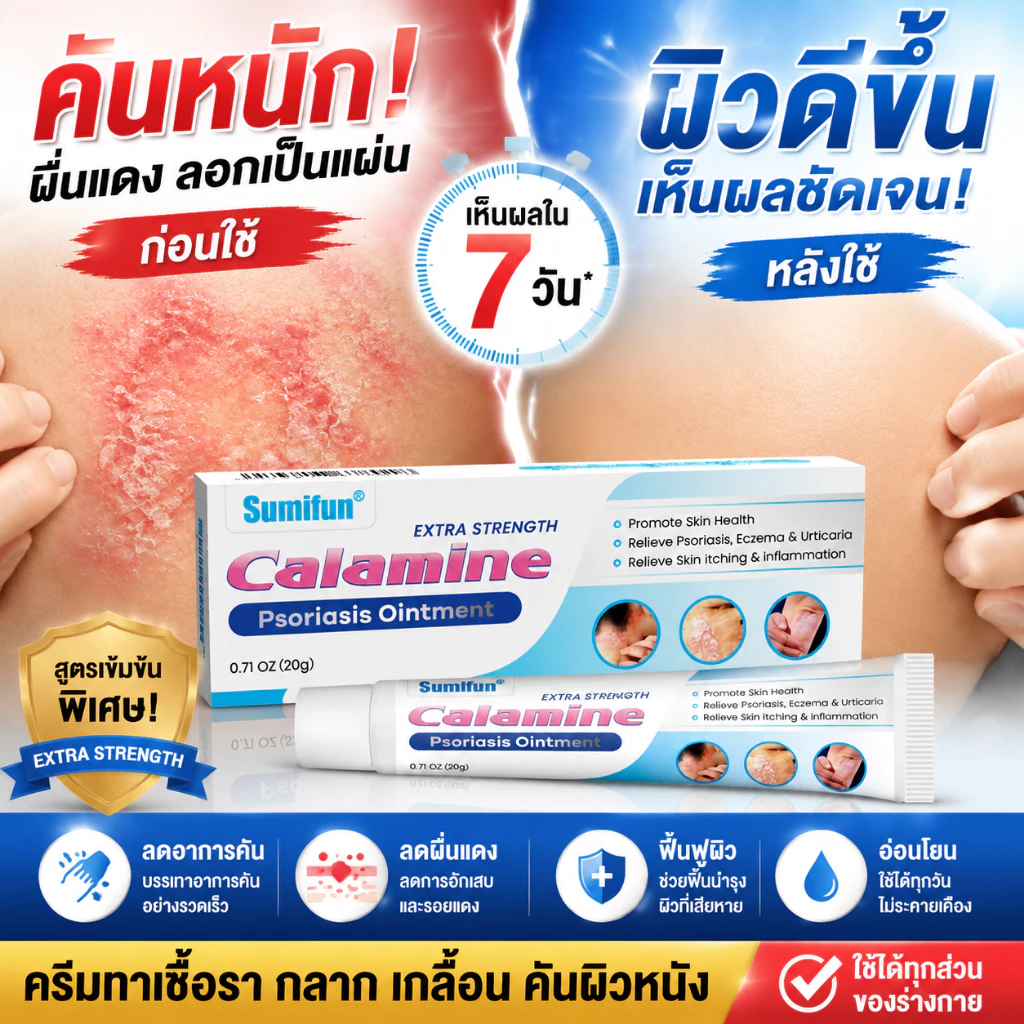 คาลาไมน์ครีม สูตรเข้มข้น ช่วยบรรเทาอาการคัน ลดผื่น และดูแลผิวระคายเคือง
