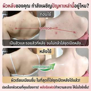 เจลอาบน้ำกำมะถัน ช่วยกำจัดไรขนาดเล็ก ลดสิวหลัง แผลอักเสบรูขุมขน ทำความสะอาดล้ำลึก เหมาะสำหรับผิวแพ้ง่าย ขนาด 500 มล
