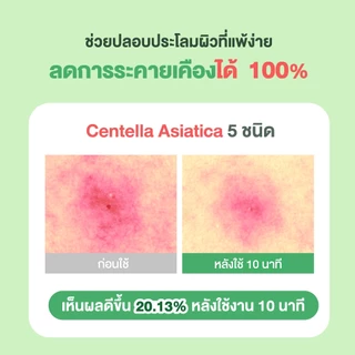 [5 แถม 1 แผ่น] Torriden Balanceful Cica Control Mask Sheet (24ml) - ทอร์ริเดน มาสก์หน้า ลดสิว ลดความมัน