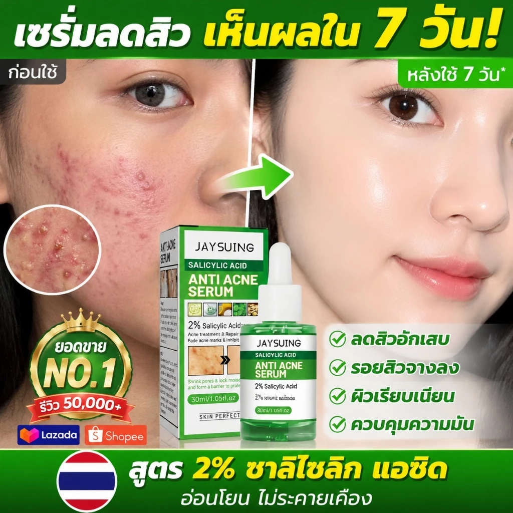 เซรั่มลดสิว 30ml ครีมเจลแต้มรักษาสิว กำจัดสิว ลดรอยสิว ทำรอยสิวจางลง