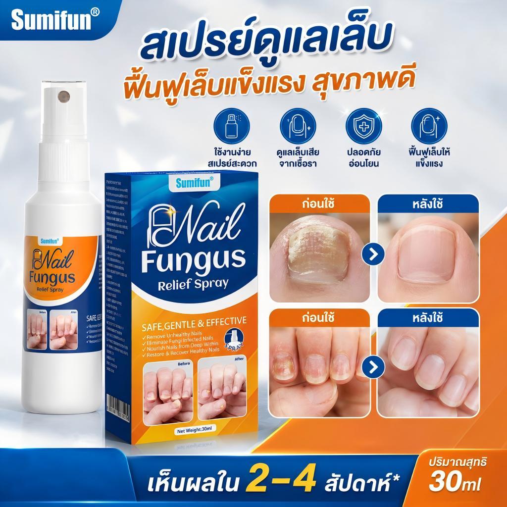 สเปรย์ดูแลเล็บ Sumifun ฟื้นบำรุงเล็บเสีย ดูแลเล็บเหลือง เล็บลอก เล็บเปราะ ช่วยให้เล็บดูเรียบเนียน สุขภาพดี ใช้ง่าย แห้งไ