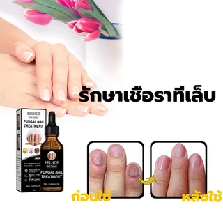 EELHOE เซรั่มซ่อมแซมเล็บ ซ่อมแซมเล็บเสีย ดูแลปัญหาเชื้อราที่เล็บ ใช้ได้ทั้งเล็บมือและเล็บเท้า ช่วยให้เล็บแข็งแรงขึ้น