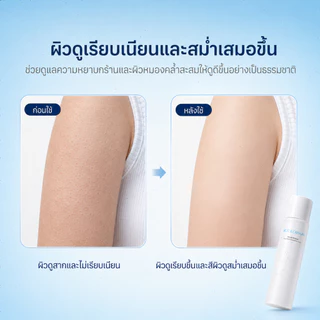 ICE LERSKIN Glycolic Acid 7% Exfoliating Toner | โทนเนอร์ผลัดเซลล์ผิว ผิวเรียบเนียน สีผิวแลดูสม่ำเสมอ