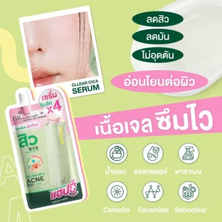 ราคาพิเศษเฉพาะในไลฟ์ ใหม่ บีเค แอคเน่ เคลียร์ ซิก้า วอเตอร์ เจล เซรั่ม เซรั่มมอยส์ 1 ซอง 8g. FG0093