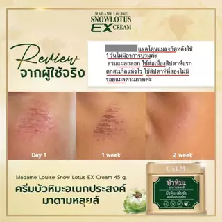 [พร้อมส่ง] [สินค้าของแท้ 100%] ครีมบัวหิมะ อีเอ๊กซ์ ครีม มาดามหลุยส์ MADAME LOUISE EX CREAM ลดการอักเสบของผิว ปริมาณ 45g