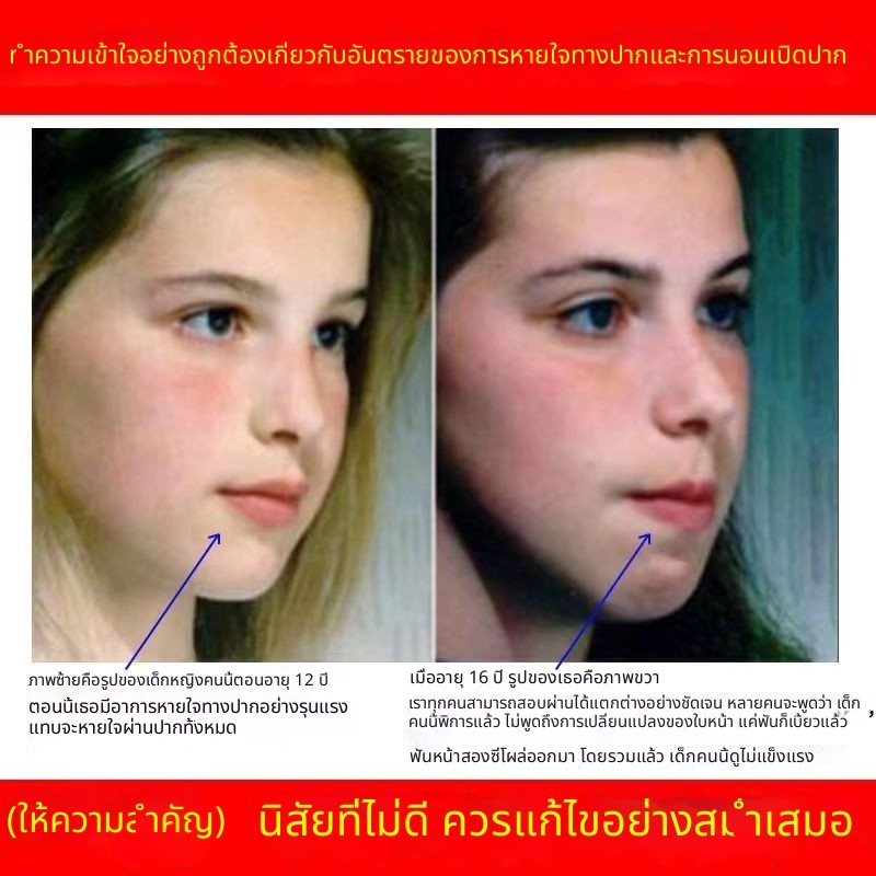 เทปปิดปากสำหรับนอนหลับ สติกเกอร์ป้องกันการกรน รูปที่ 4