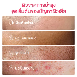 【ซื้อ 2 แถม 1】SKINTIFIC 2pcs moisturizer 5เอ็กซ์ เซราไมด์ มอยส์เจอร์ ครีมทาหน้า ไนอาซินาไมด์ โทนอัพ มอยเจอร์ไรเซอร์