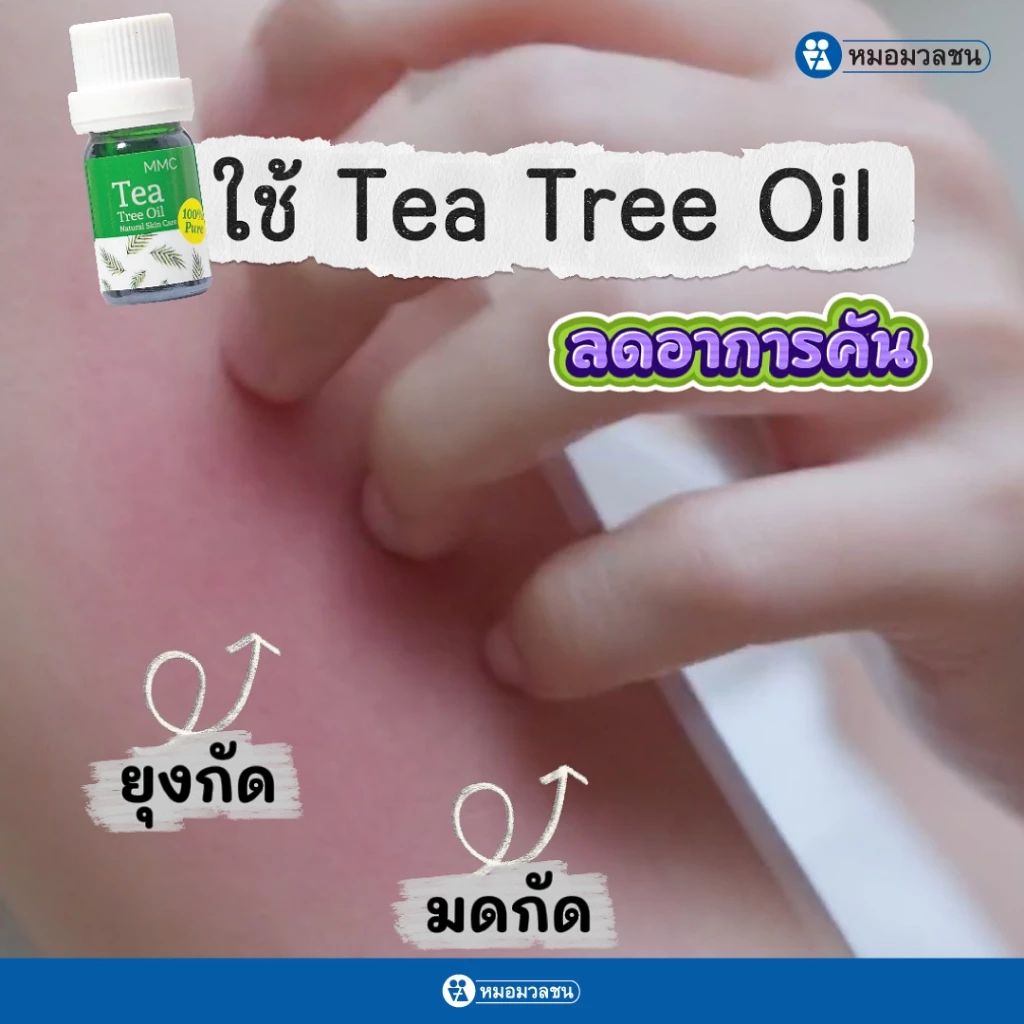 หมอมวลชน MMC Tea Tree Oil น้ำมันทีทรีบริสุทธิ์ thumbnail 4