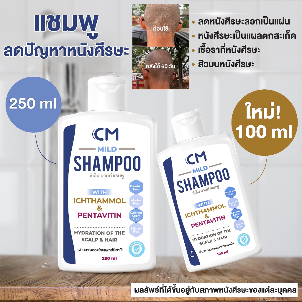แชมพูลดปัญหาหนังศีรษะลอก แห้ง คัน CM Mild Shampoo ผมไม่แห้งกระด้าง ดีกว่า TAR(ทาร์) cosma