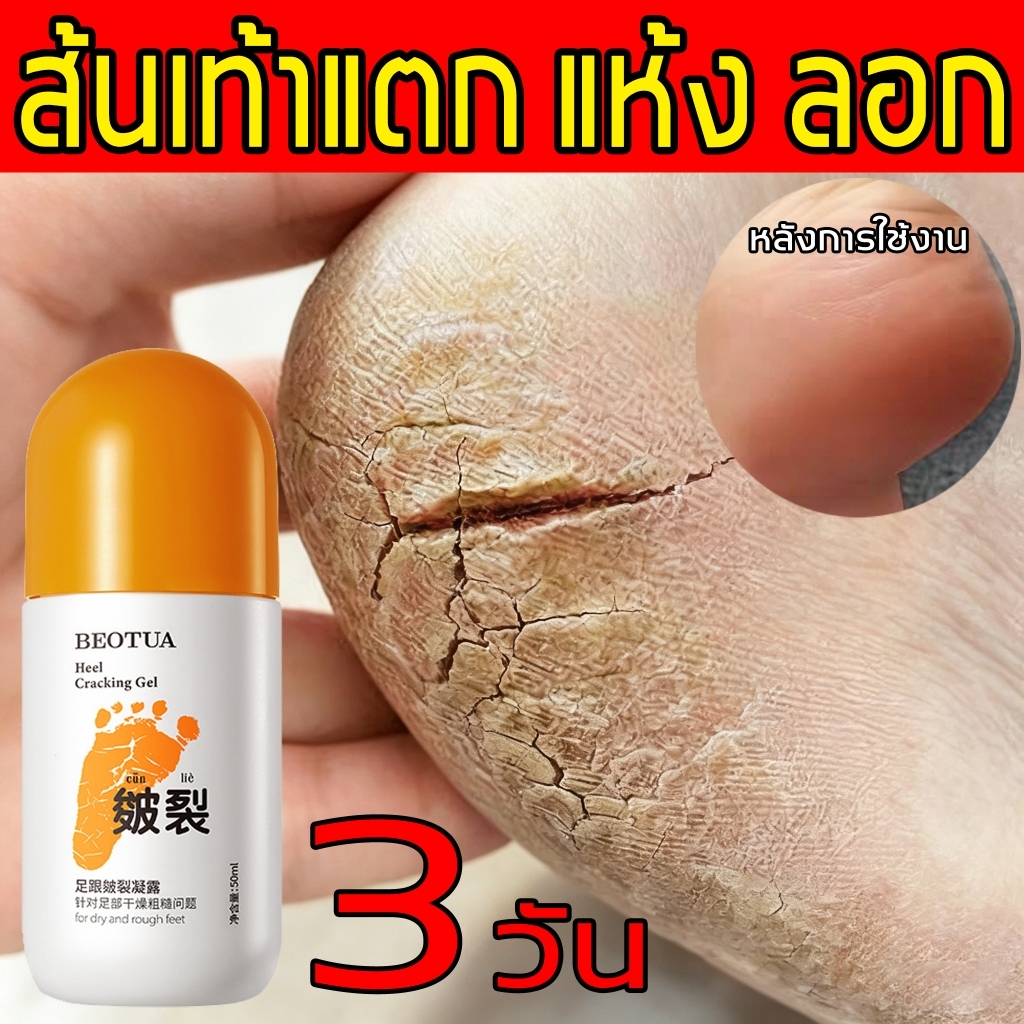 ชุ่มชื้นและนุ่มนวล ครีมบำรุงส้นเท้าแตก ครีมทาส้นเท้า ส้นเท้าแตก เพิ่มความชุ่มชื้น ฟื้นฟูผิว สูตรธรรมชาติ พกพาสะดวก