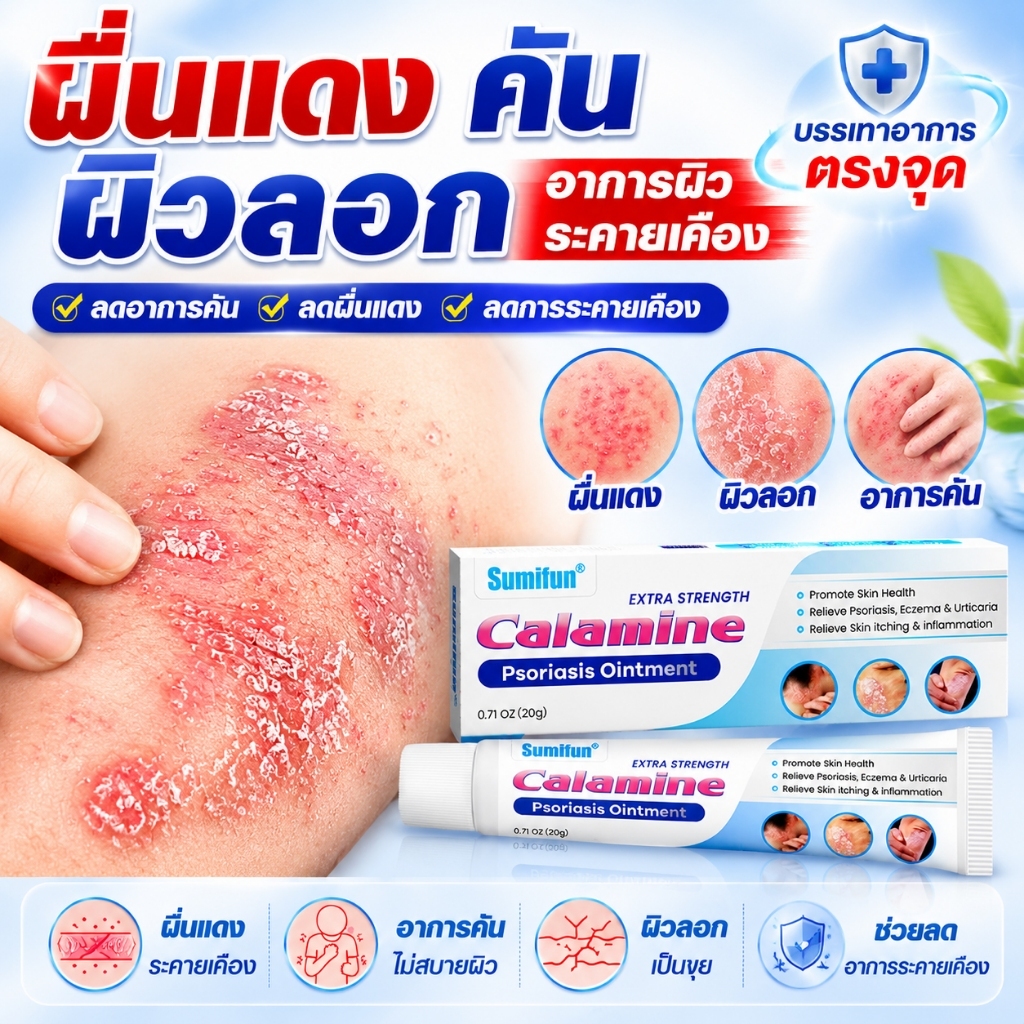 บรรเทาอาการคัน ครีมแก้เชื้อรา รักษาโรคสะเก็ดเงิน กลาก ผื่นแพ้ ลมพิษ และผิวหนังอักเสบได้อย่างมีประสิทธิภาพ อ่อนโยน 20g
