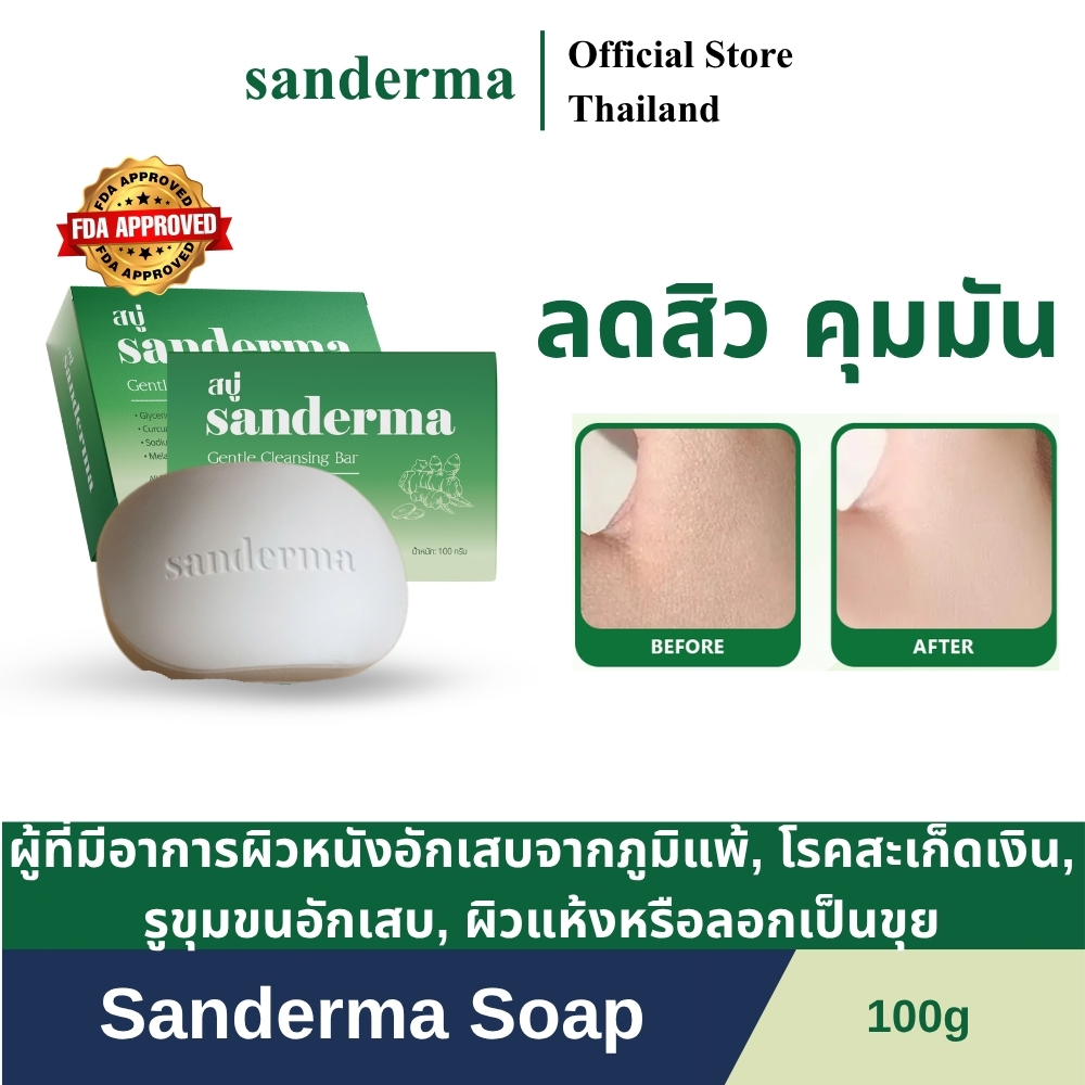 Sanderma สบู่สมุนไพร ลดสิวที่หลัง ลดอาการคัน อ่อนโยนต่อผิวแพ้ง่าย 100 กรัม