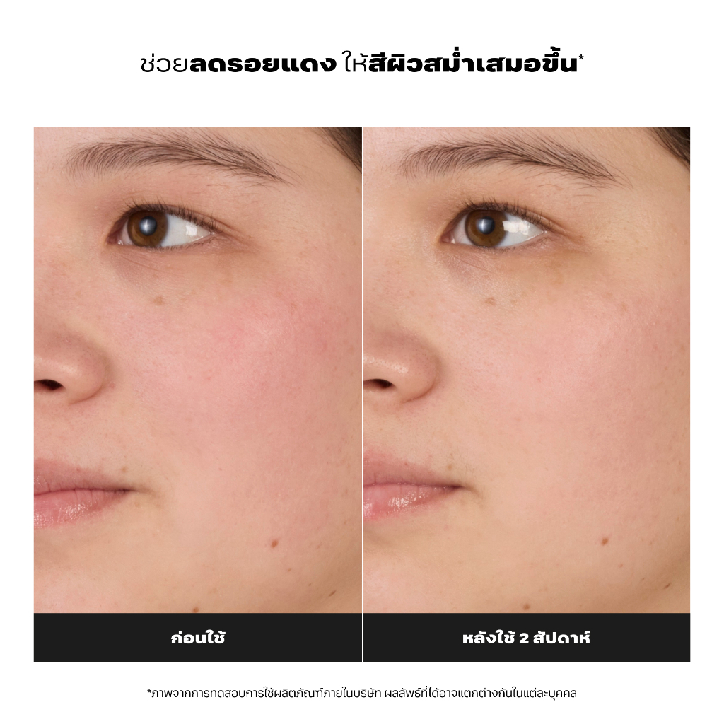 Paula's Choice تونر Skin Balancing لتضييق المسام — صورة 7