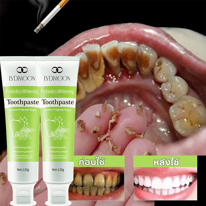 LYDIMOON ฟันไวท์เทนนิ่งยาสีฟันยาสีฟันโปรไบโอติก Deep Clean ฟัน 120g ฟันไวท์เทนนิ่ง Antibiotic Anti-C