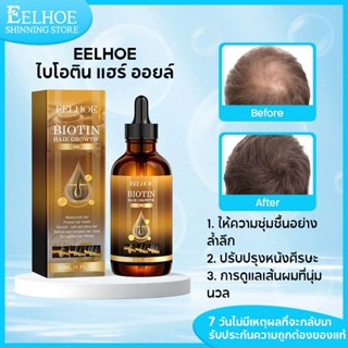 【ซื้อ 1 แถม 1】เซรั่มปลูกผม เซรั่มผม ไบโอติน ออยบํารุงผม เซรั…