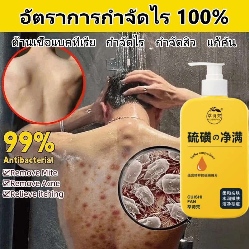 ครีมอาบน้ํา  สบู่ลดสิว ลดสิว ลดสิวอุดตัน สิวที่หลัง กำจัดไร ทําความสะอาดล้ําลึก ให้ความชุ่มชื้นและฟื้นฟูผิวอ่อนนุ่ม