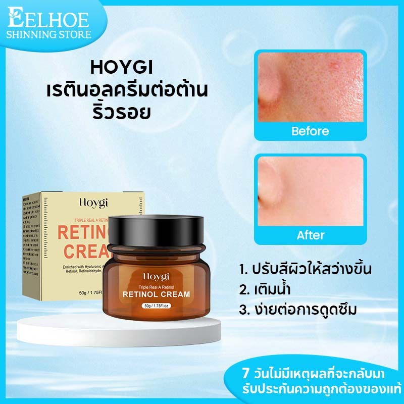 【 1 แถม 1】Hoygi ครีมเรตินอล 50g เรตินอลครีม ครีมกลางคืน ลดริ้วรอย ลดฝ้ากระ ผิวแข็งแรง โทนอัพskinest 
