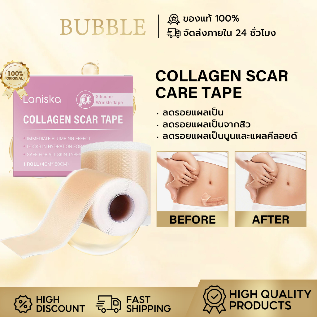 Laniska แผ่นแผลเป็นซิลิโคนคอลลาเจน แปะรอยแผลเป็น แผ่นแปะลดรอยแผลเป็นนูน ลดรอยแผลเป็นนูน แผลคีลอยด์ คีลอยด์สิว Scar Tape