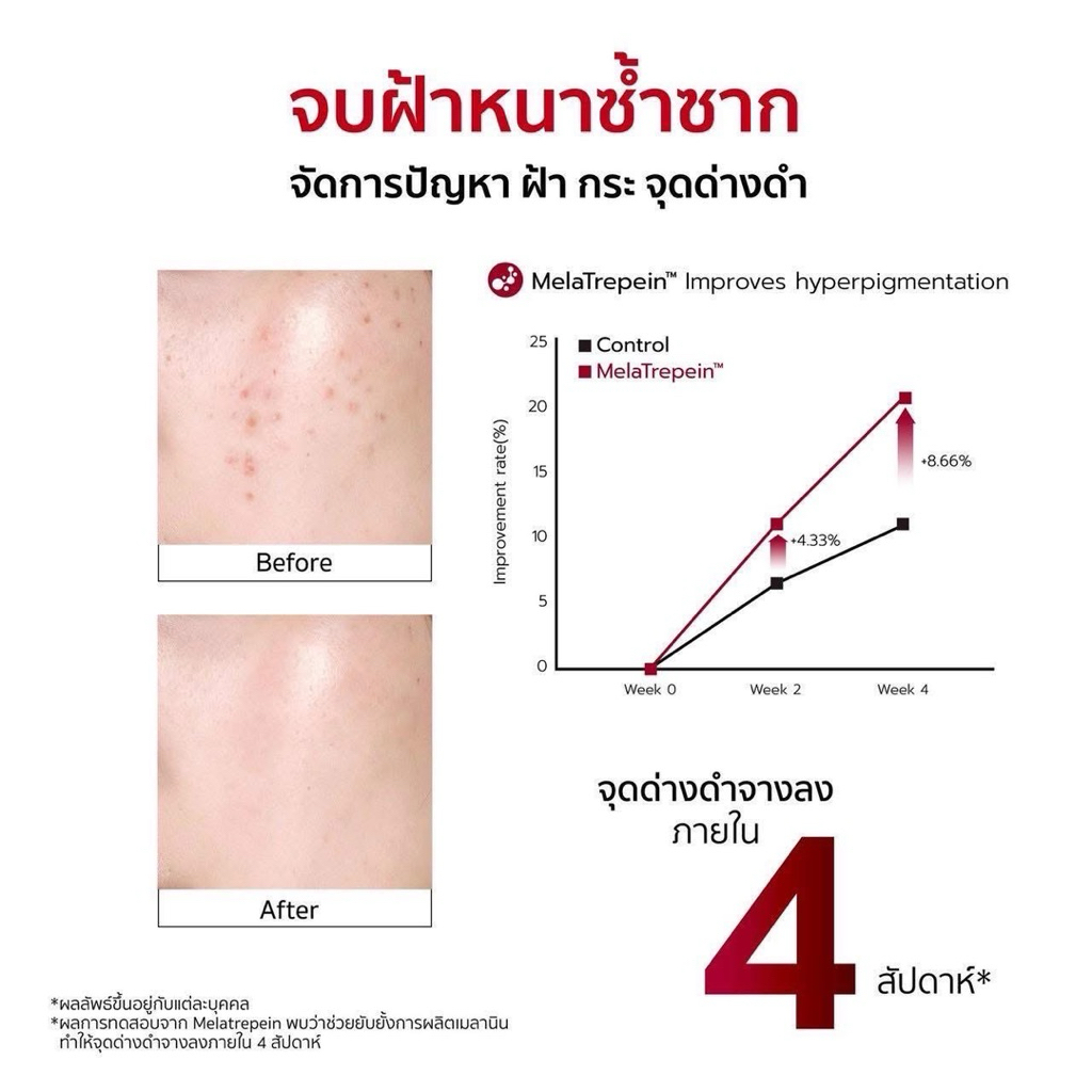 YERPALL SET [เซรั่มสตอ+สบู่เซรั่มสด] ลดสิว รอยดำรอยแดงฝังลึก ผิวดูกระจ่างใส แถมเฟิร์สแคร์ — صورة 5