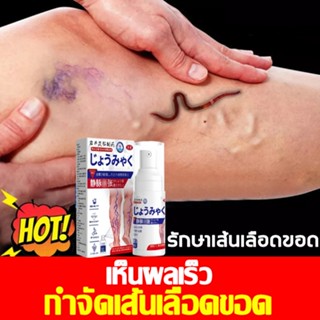 ไม่ได้ผลคืนเงิน ครีมทาเส้นเลือดขอด รักษาขาให้สวย ครีมเส้นเลื…