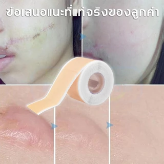 South Moon รักษารอยแผลเป็น แผ่นแปะแผลเป็น กําจัดรอยแผลเป็นจากแผลเป็น เผยผิวเนียนสวย