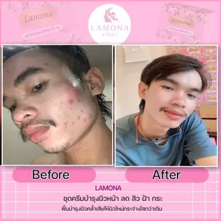 ครีมไข่มุกแท้ ลาโมน่า เพอร์เฟ็ค เดย์ครีม ครีมกลางวัน Lamona Perfect Day Cream ของแท้ 100% รับตรงจากแบรนด์