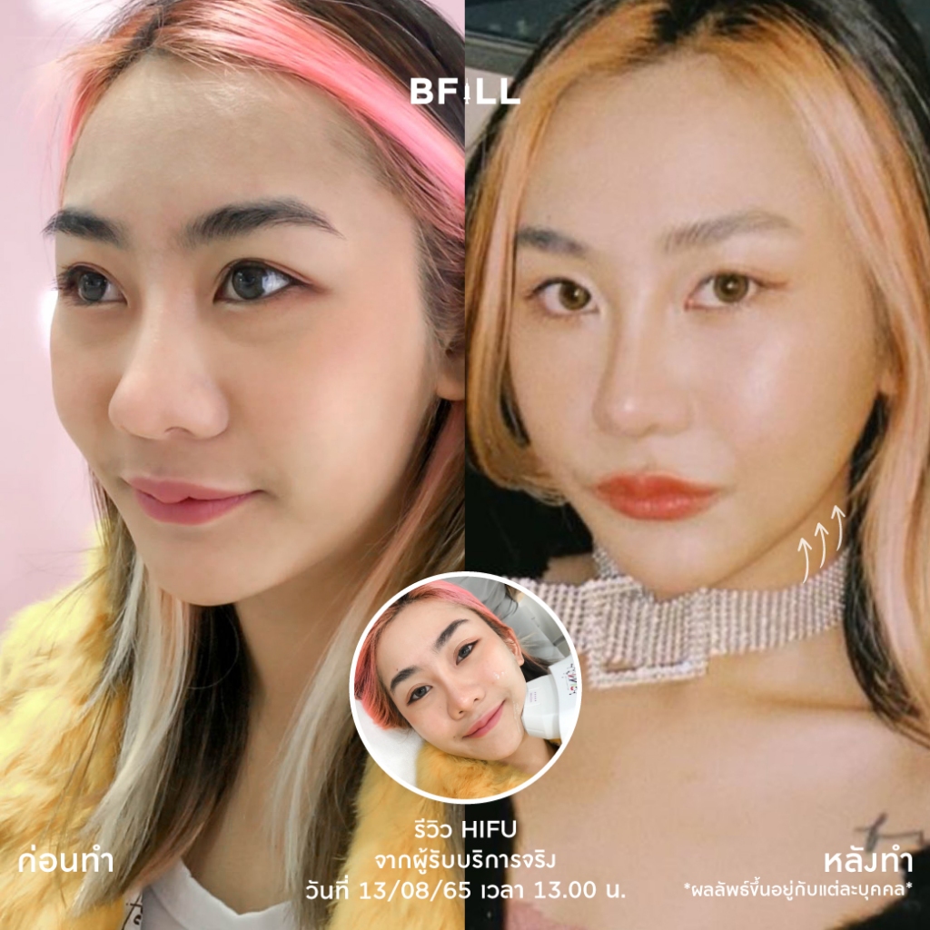 รูปภาพ 4