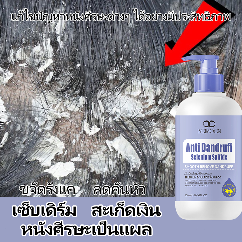 แชมพูแก้คัน ยาสระผมขจัดรังแค แชมพูขจัดรังแค 300ML แก้รังแค แก้คัน ขจัดรังแค ลดคันหัว ลดความมัน รักษาเซบเดิร์ม ลดผมร่วง