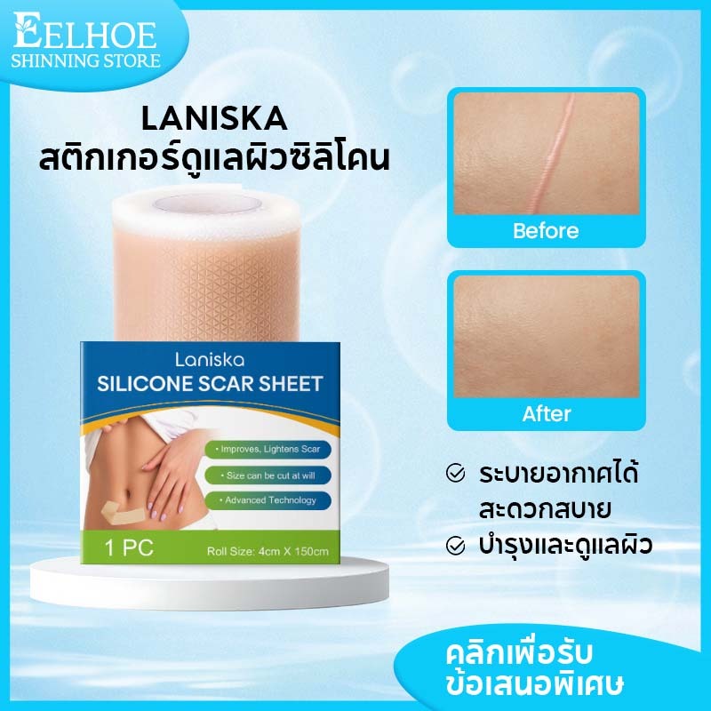 Laniska ซิลิโคนแปะแผลเป็น แผ่นซิลิโคน รอยแผลเป็นแปะแผลเป็น ลดแผลเป็น แผลเป็น silicone scar sheet 1pc