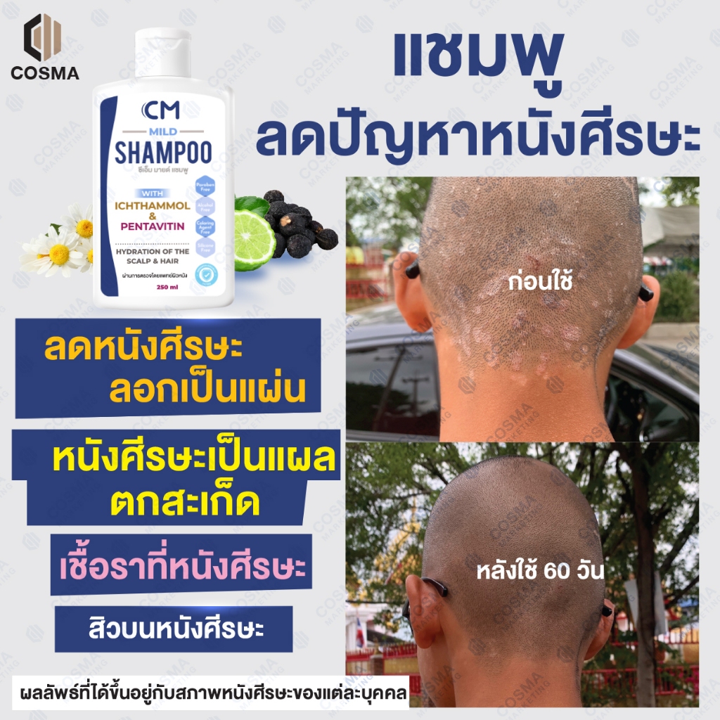 แชมพูหนังศีรษะลอก แห้ง คัน CM Mild Shampoo ผมไม่แห้งกระด้าง ดีกว่า TAR(ทาร์) [ Exp:23/09/27 ]