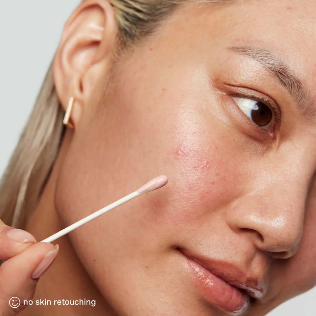 🛍️ส่งทุกวัน🛍️ แพคเกจใหม่ Kate Somerville Eradikate Acne Treatment *รับประกันของแท้*Exp.07/27 แต้มสิวขายดี - รูปที่ 5