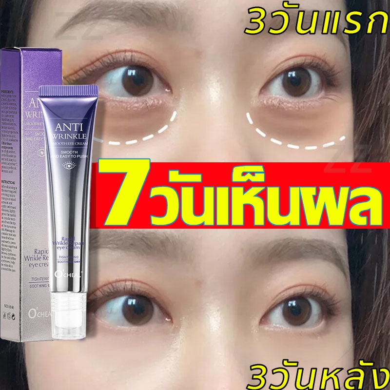 ครีมบำรุงรอบดวงตา 20G ดูแลรอบดวงตาและ ครีมลดถุงใต้ตา ลดรอยคลำ้ใต้ตาลด ริ้วรอย