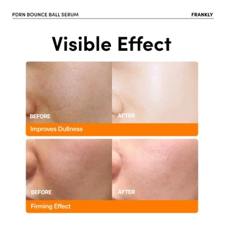 FRANKLY PDRN Bounce Ball Serum | แฟรงคลี พีดีอาร์เอ็น บาวซ์บอล เซรั่ม | FRANKLY Official Store