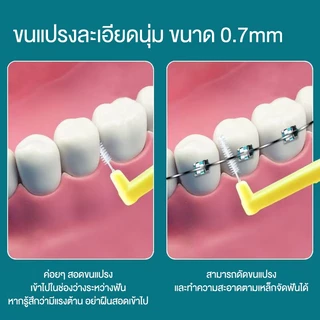 แปรงทำความสะอาดซอกฟัน พร้อมกล่องเก็บ หัวแปรงขนนิ่ม อุปกรณ์สำหรับคนจัดฟัน ขัดฟัน ขนาดพกพา แปรงสีฟันสำหรับคนจัดฟัน แปรงซอก